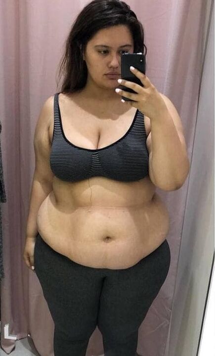 Fazla kilolarım yüzünden vücudumdan nefret ediyordum.